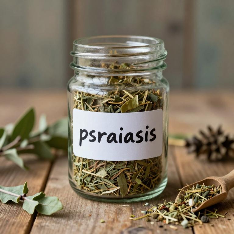psoriasis remedies