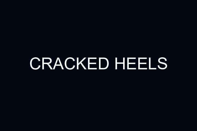 cracked heels overview