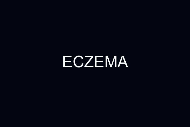 eczema overview