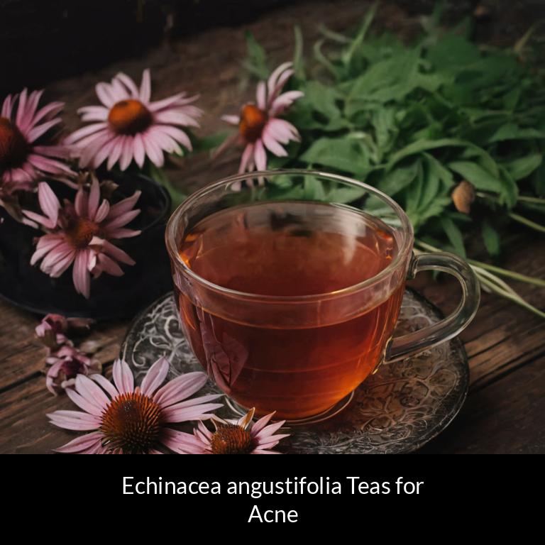 herbal teas for acne echinacea angustifolia herbs