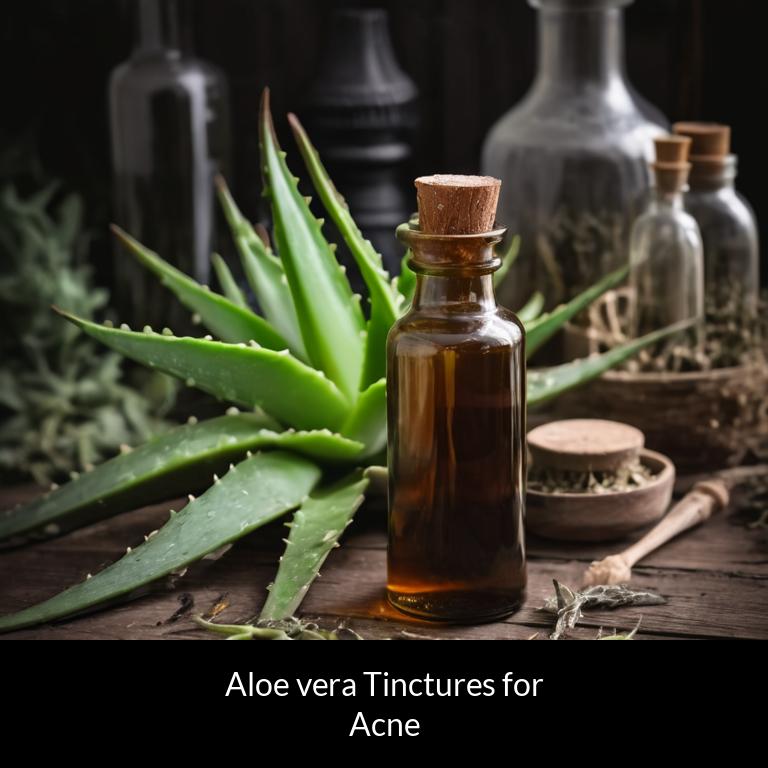 herbal tinctures for acne aloe vera herbs
