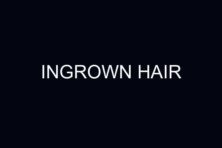 ingrown hair overview