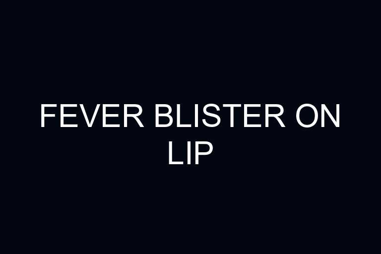 fever blister on lip overview