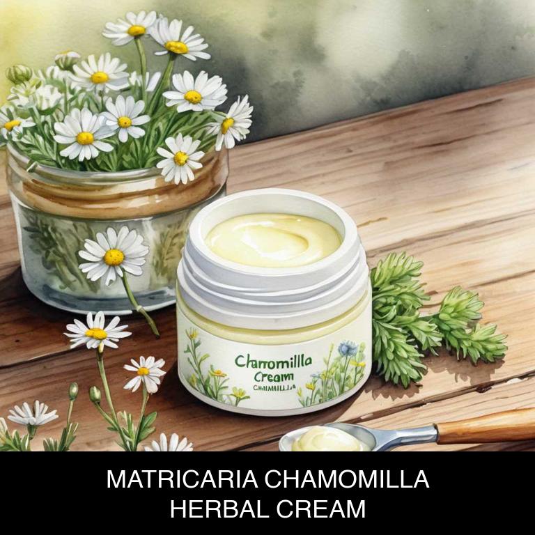 matricaria chamomilla herbal creams for burns