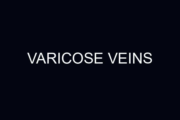 varicose veins overview